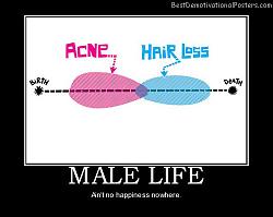 Click image for larger version. 

Name:	male-life-acne-hair-loss-best-demotivational-posters.jpg 
Views:	165 
Size:	28.9 KB 
ID:	594743
